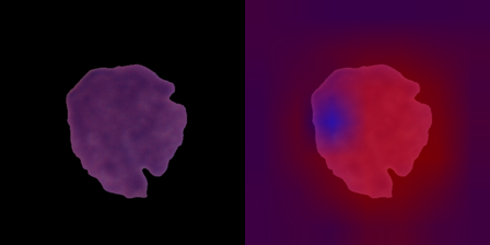 Grad-CAM of a leukemic cell — attention concentrated on the cell body, not the background
